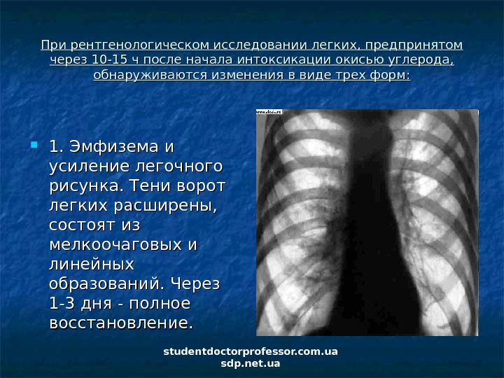 Исследование легких. Легочный рисунок усилен. Отравление угарным газом рентген легких. Рентгенологическое исследование легких. Рентгенологический метод послойного исследования легких.