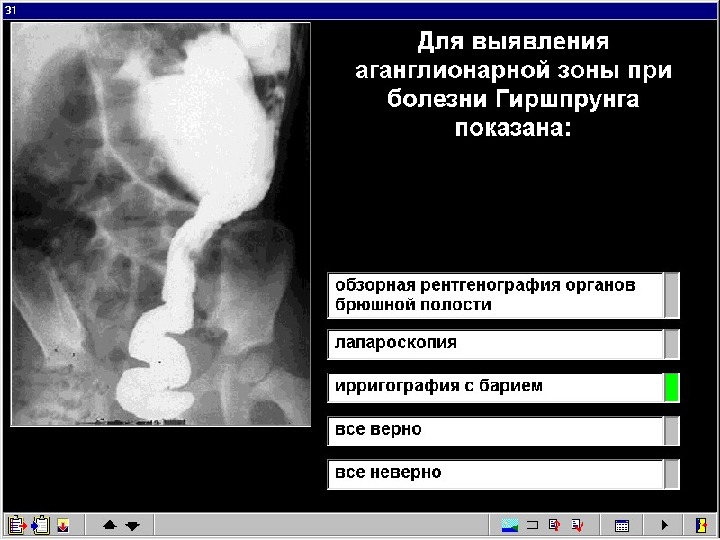 Клиническая картина ректальной формы болезни гиршпрунга характеризуется