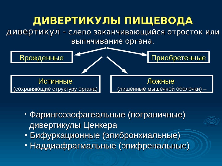 Диагностика дивертикула пищевода