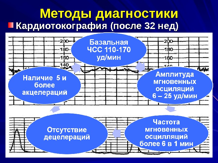 Дистресс плода презентация