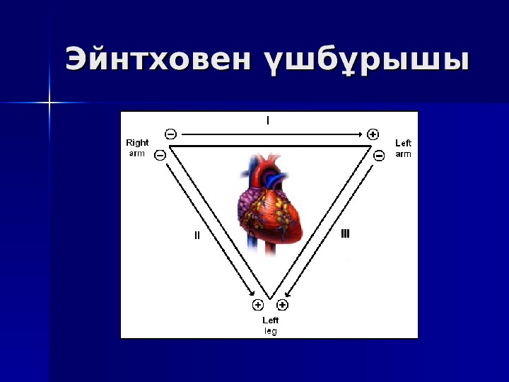 Треугольник эйнтховена схема