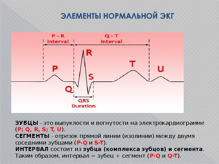 Экг рисунок с обозначениями