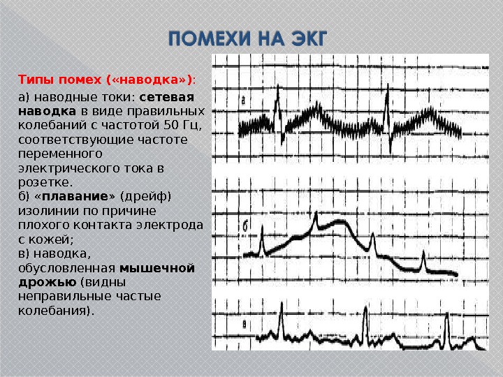 Экг презентация қазақша