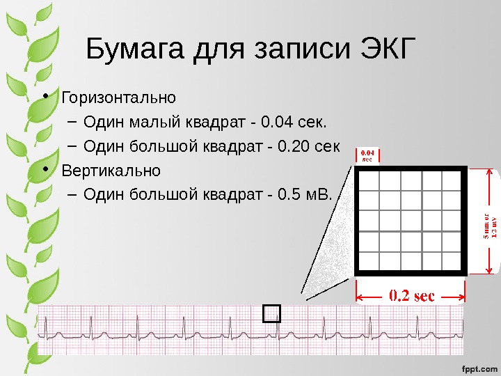 История экг презентация