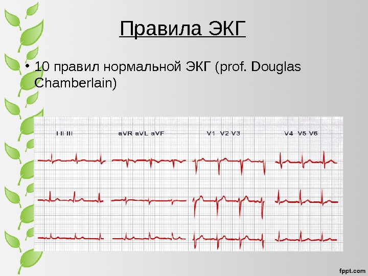 Экг презентация терапия