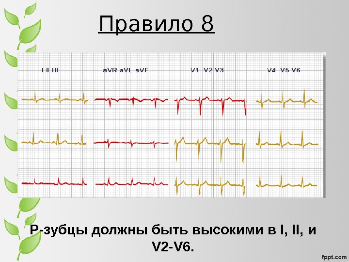 История экг презентация