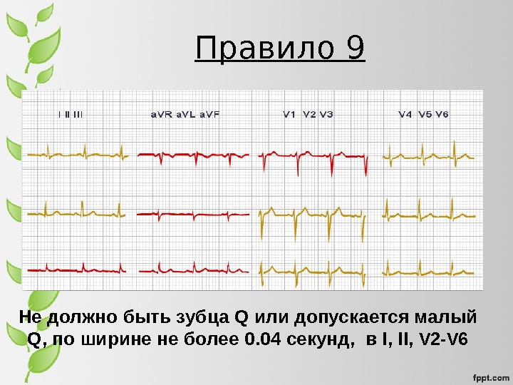 Презентация экг для студентов