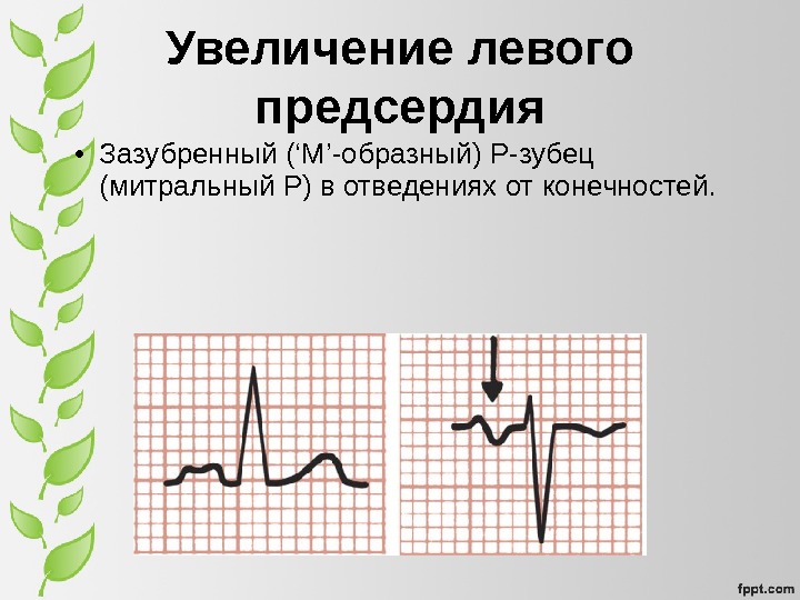 Основы экг презентация