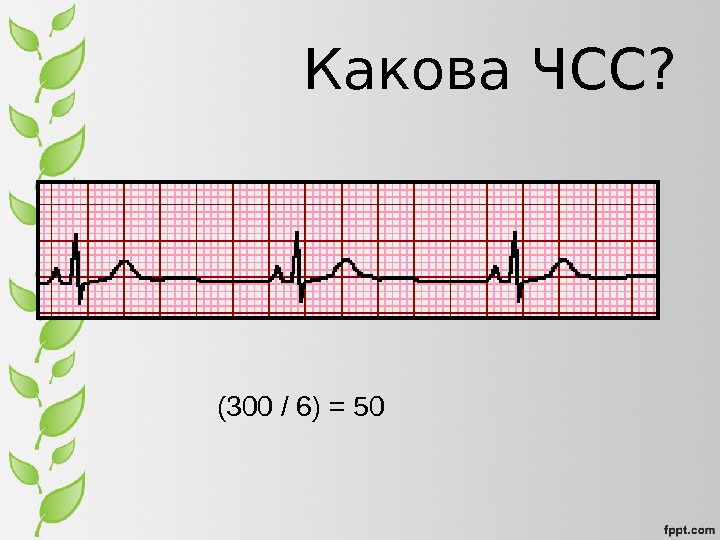 История экг презентация