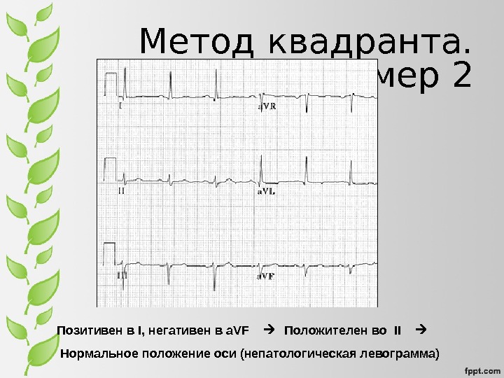 История экг презентация