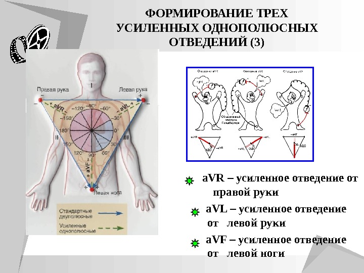 12 отведений экг схема