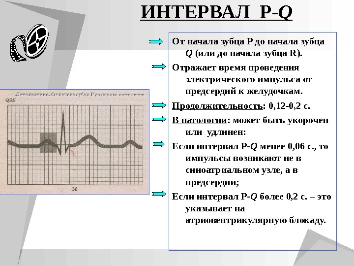 Презентация пропедевтика экг