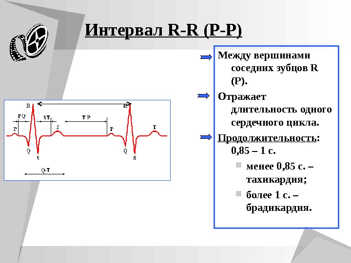 R составляющая. Интервал r-r ЭКГ. Интервалы r-r на ЭКГ отражает. Интервал рр на ЭКГ норма. Расстояние RR на ЭКГ В норме.