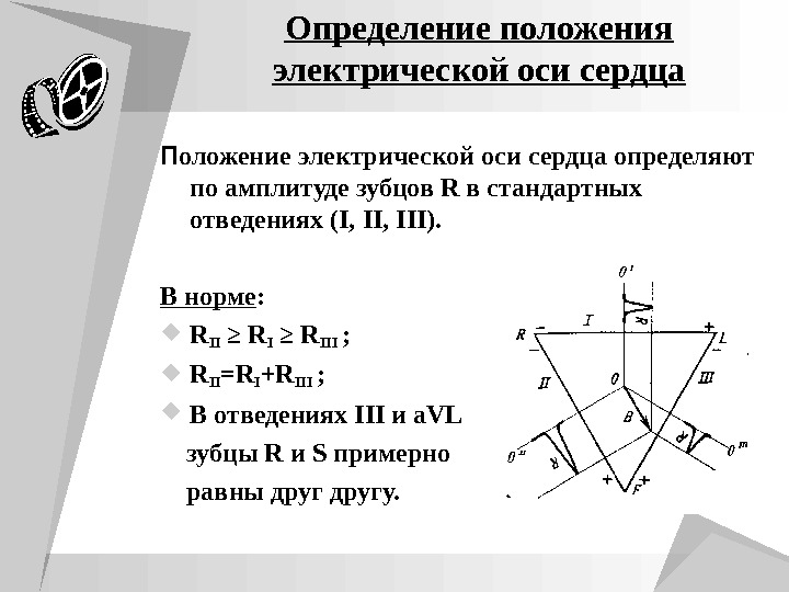 Нормальное направление. Положение электрической оси сердца. Направление оси сердца. Варианты расположения электрической оси сердца. Горизонтальное положение электрической оси сердца.