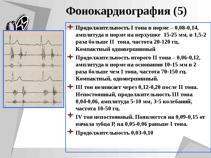 Презентация пропедевтика экг