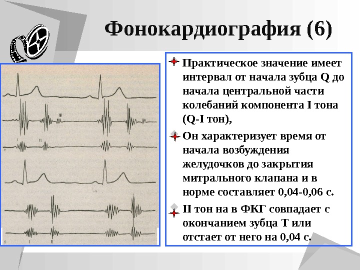 Презентация пропедевтика экг