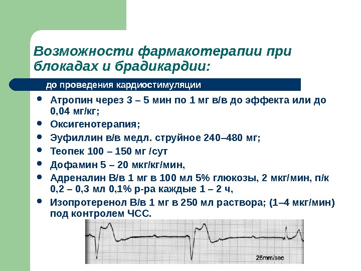 Брадикардия сердца у взрослых. Введение атропина при брадикардии. Атропин при брадикардии у детей. Атропин при брадикардии доза. Атропин при блокаде.