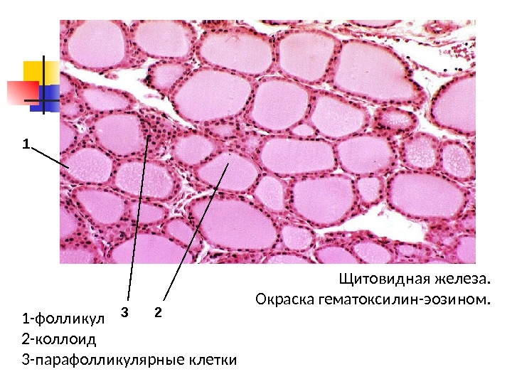 Предстательная железа гистология рисунок