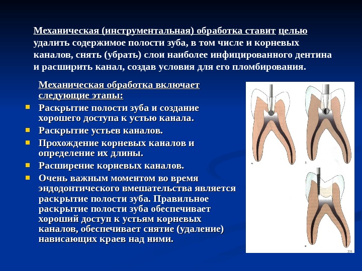 Эндодонтическое лечение презентация