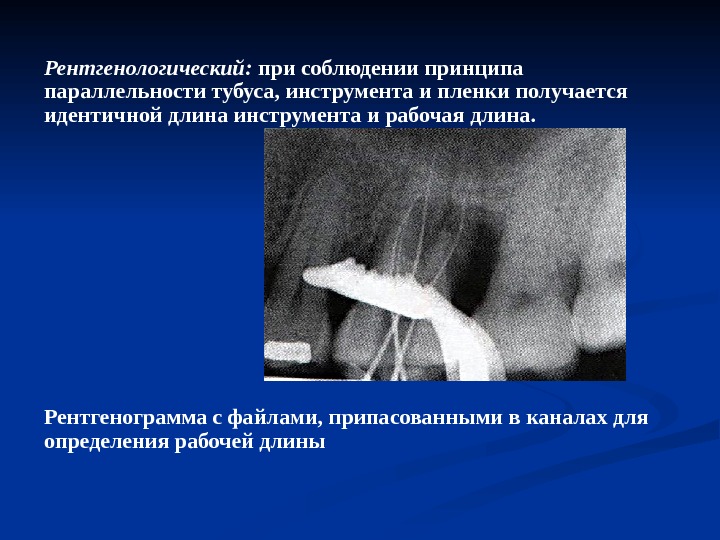 Регенеративная эндодонтия презентация