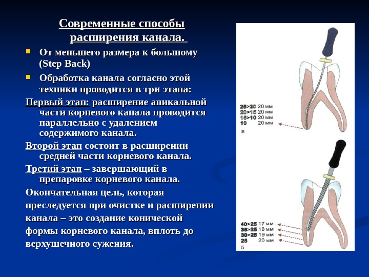 Эндодонтическое лечение презентация