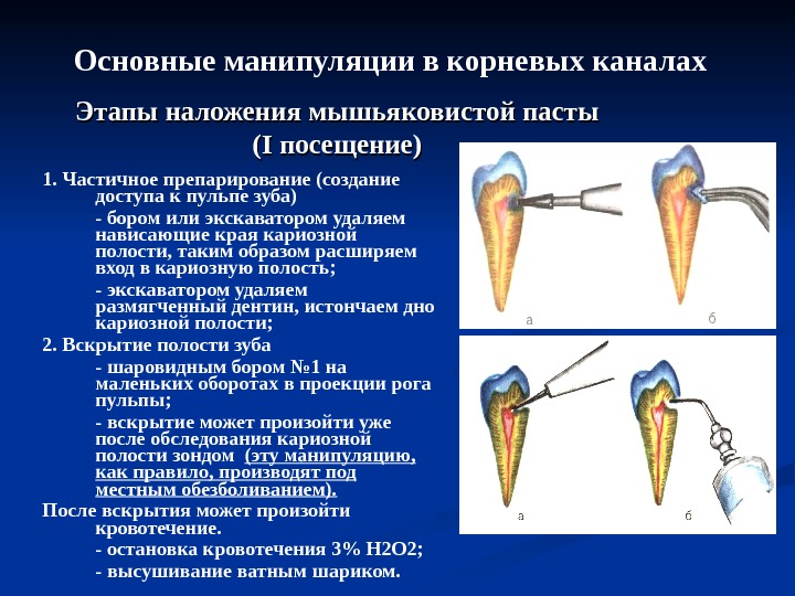 Регенеративная эндодонтия презентация