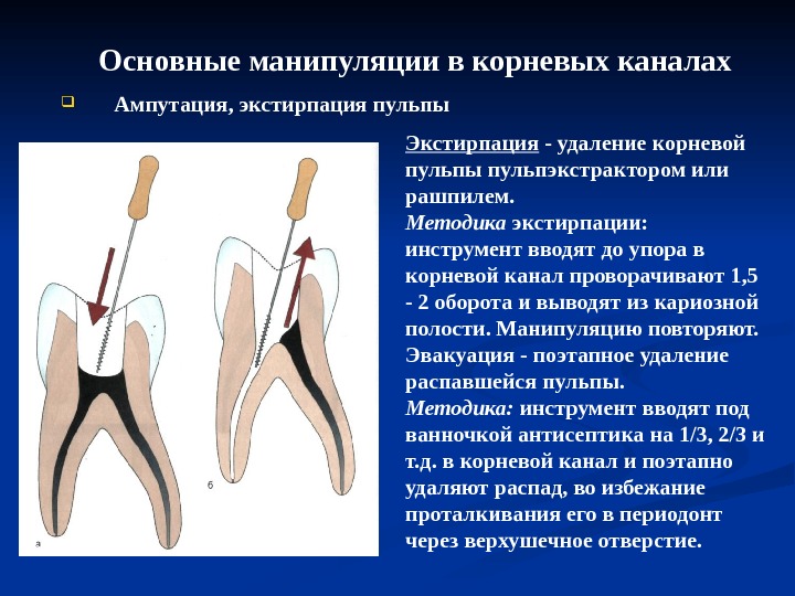 Рентгенография в эндодонтии презентация