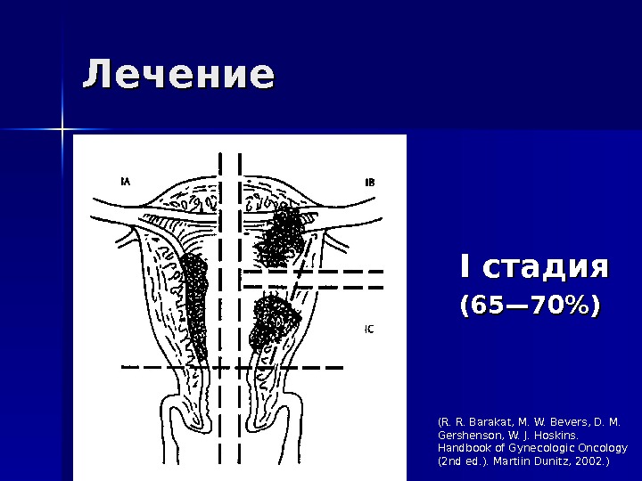 Презентация злокачественные опухоли