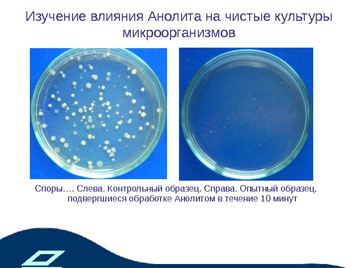 Чистая культура микроорганизмов это. Накопительные и чистые культуры микроорганизмов. Чистая культура это микробиология. Чистая культура бактерий это. Накопительная культура микроорганизмов это.