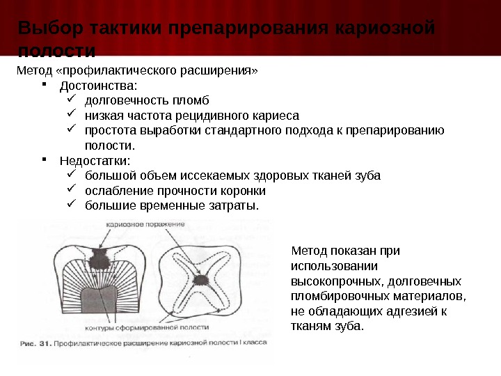 Методы расширения. Метод профилактического расширения по Блэку. Метод профилактического расширения кариозной полости. Методы пломбирования кариозных полостей. Выбор тактики препарирования кариозных полостей..