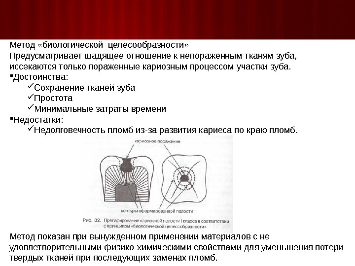 Целесообразный метод. Метод биологической целесообразности. Принципы препарирования кариозных полостей по Лукомскому. Методика препарирование + пломбирование кариозной полости. Методы пломбирования кариозных полостей.