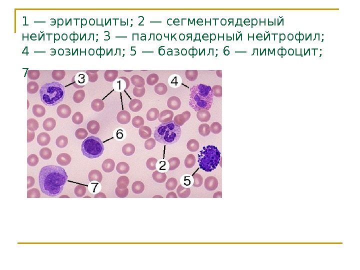 Палочкоядерные нейтрофилы картинки