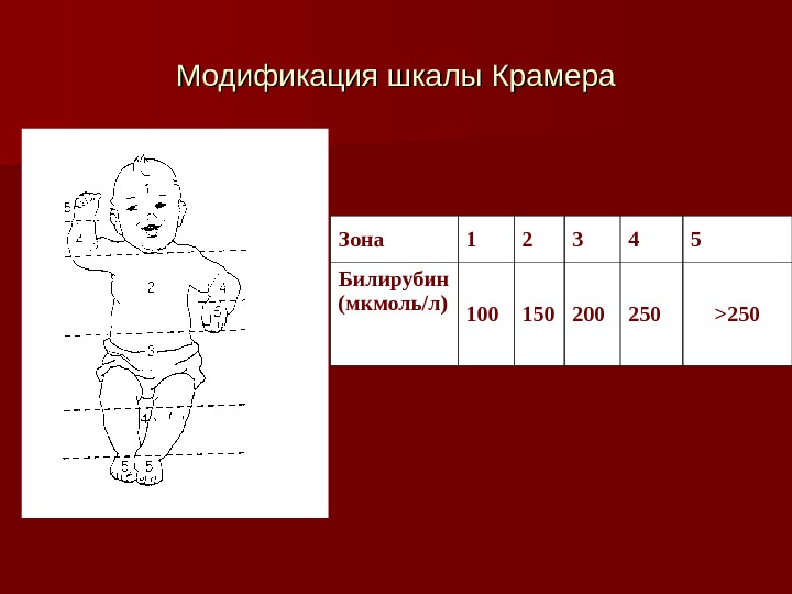 Гемолитическая болезнь новорожденных педиатрия презентация