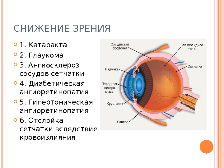 Презентация глаукома катаракта