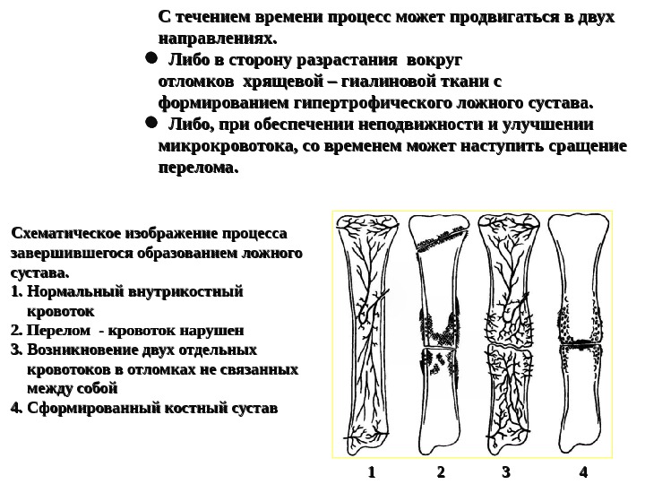 Течение времени процесс