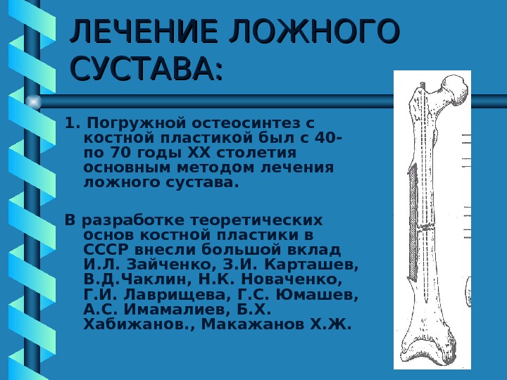 Ложный сустав презентация