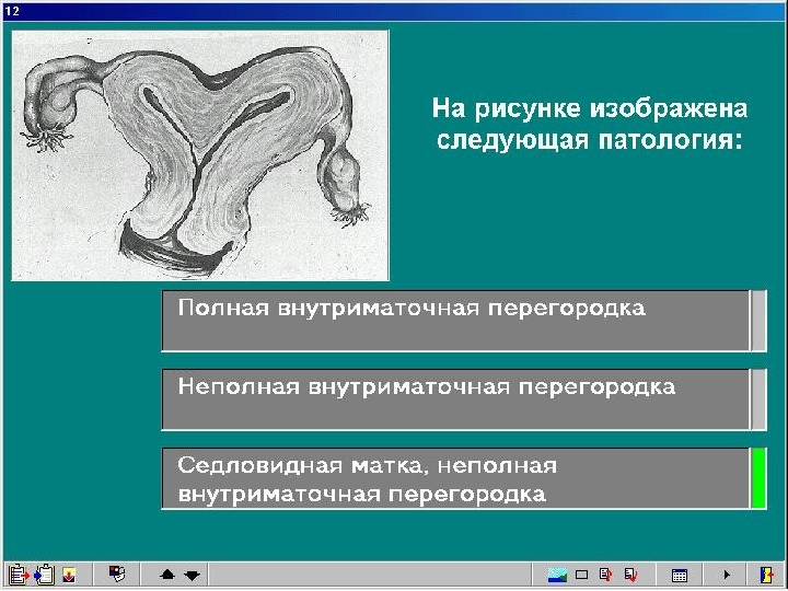 Внутриматочная патология презентация