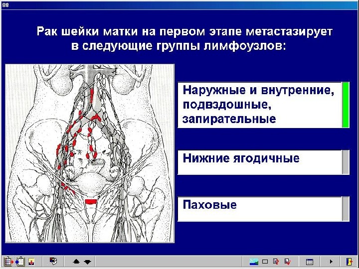 Подвздошные лимфоузлы где находятся у женщин фото расположение