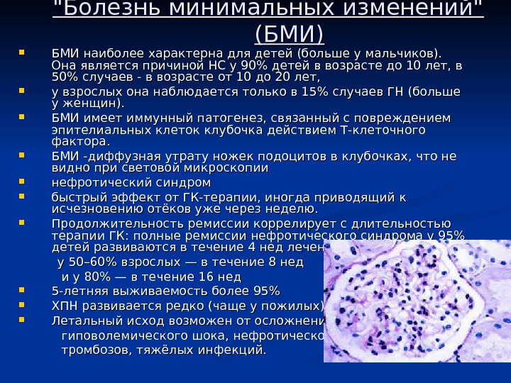 Минимальных изменений. Болезнь минимальных изменений гломерулонефрит. Диагноз болезнь минимальных изменений. Болезнь минимальных изменений клубочков. Болезнь минимальных изменений осложнения.