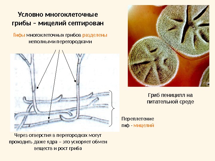 Гифы мицелия. Септированный мицелий гриб. Пеницилл септированный мицелий. Мицелий септированный и многоклеточный. Септированные мицелий это.