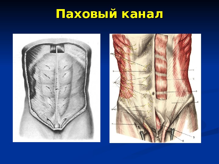 Паховый канал у мужчин фото