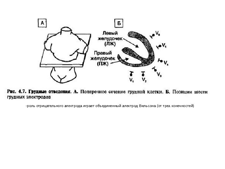 Лев желудочка. Объединенный электрод Вильсона. Электрод в левом желудочке. Отрицательный Объединенный электрод Вильсона. Эхо сегменты левого желудочка.