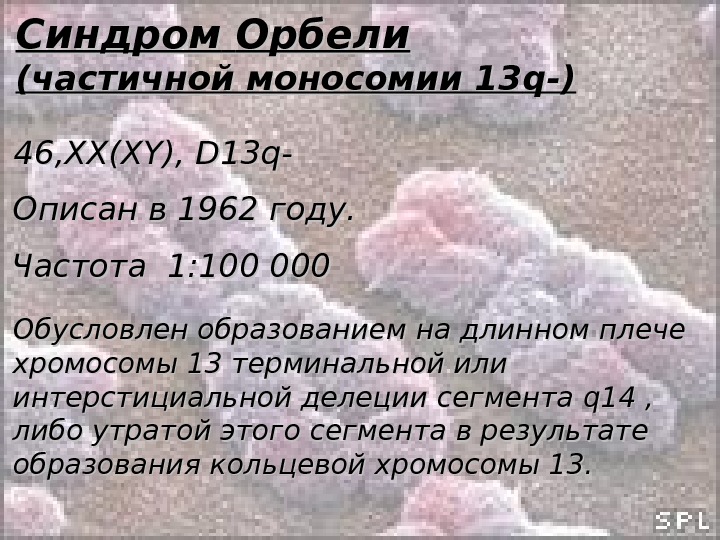 Синдром орбели презентация