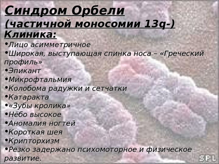 Синдром орбели презентация