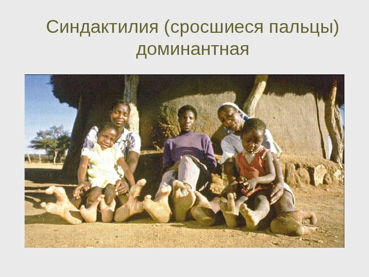 Доминантные и рецессивные признаки человека Доминантные