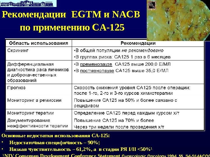 Са 125 повышен причина