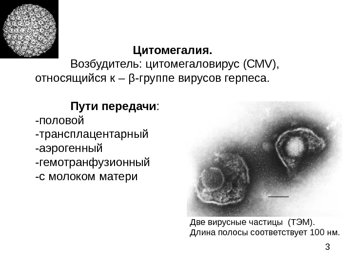 Циталомегавирус. Возбудитель цитомегаловирусной инфекции микробиология. Вирусные (цитомегаловирусная инфекция,. Врожденная ЦМВ инфекция.