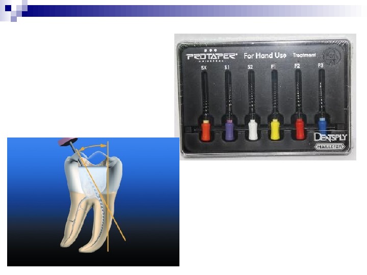 Инструменты для эндодонтии в стоматологии описание и фото