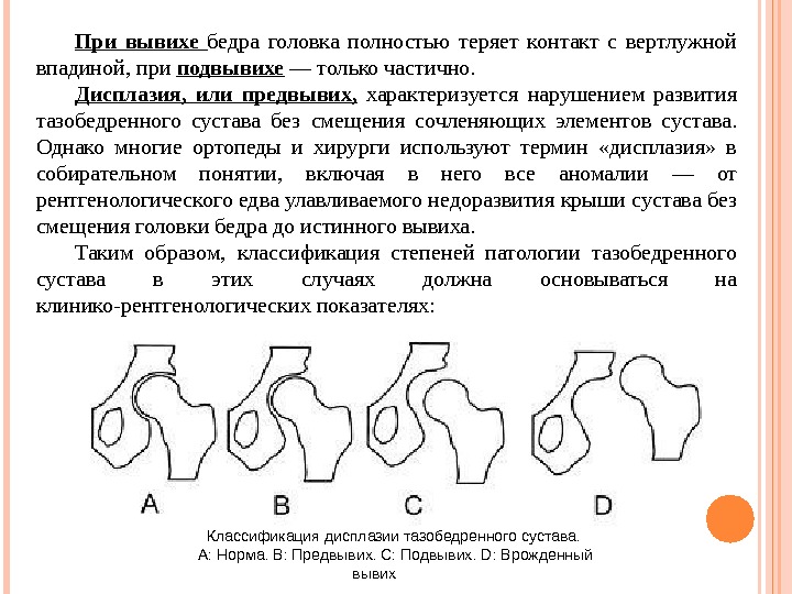 Дисплазия у новорожденных тазобедренных суставов в картинках