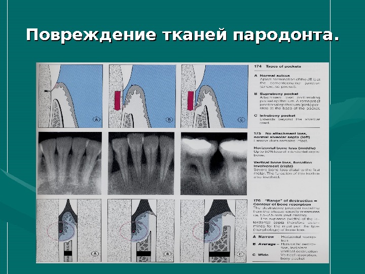 Карта исследования пародонта